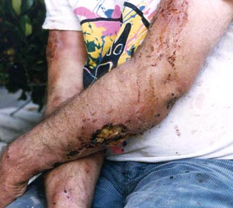 glendale-crystal-meth-addiction-722413.jpg glendale-crystal-meth-addiction-722413.jpg